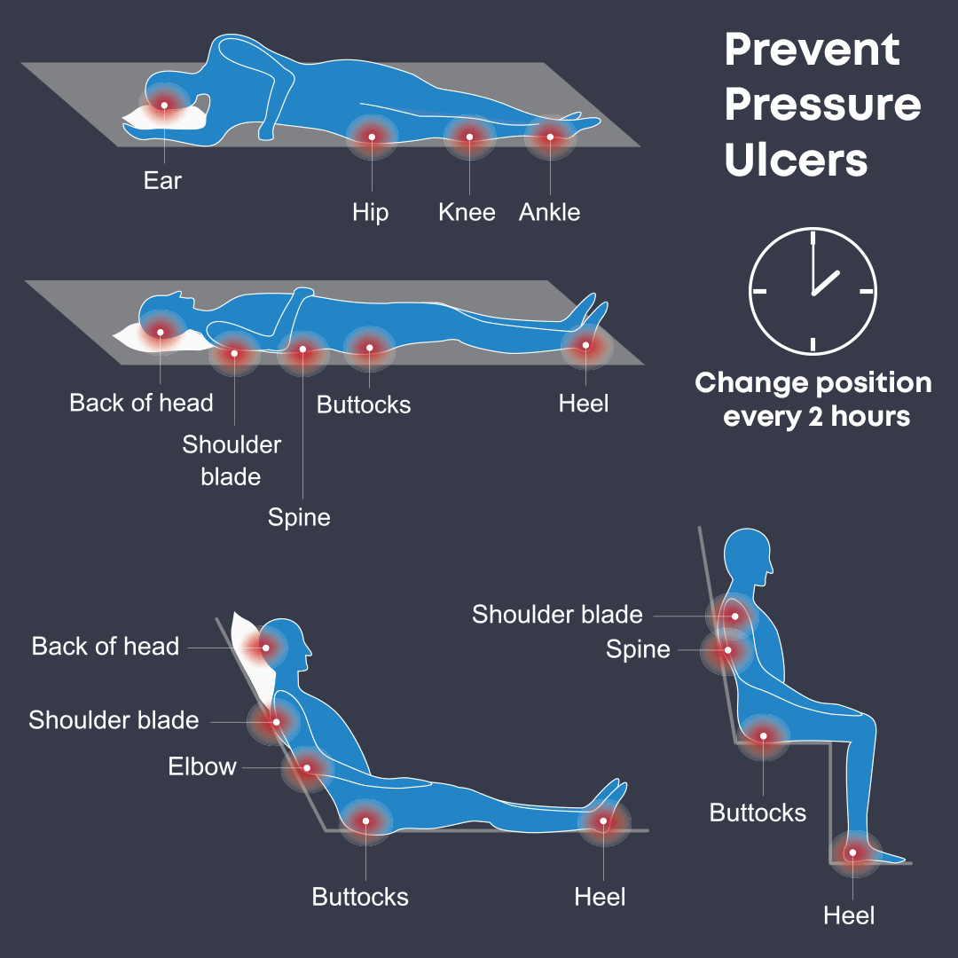 Causes and prevention of pressure sores, Coping with cancer