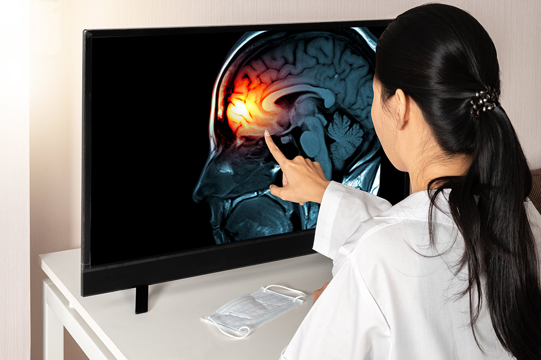 doctor using touch-screen of brain imaging