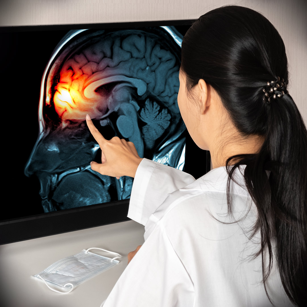 researcher reviewing brain scan